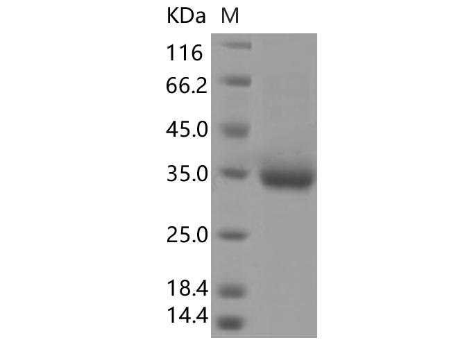 SARS-CoV-2 Spike Glycoprotein Protein - Recombinant SARS-CoV-2 Spike RBD(P384L)(His Tag)