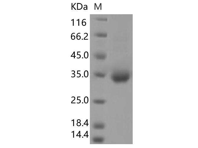 SARS-CoV-2 Spike Glycoprotein Protein - Recombinant SARS-CoV-2 Spike RBD(A348S)(His Tag)