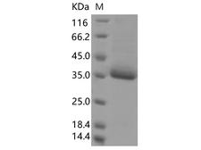SARS-CoV-2 Spike Glycoprotein Protein - Recombinant SARS-CoV-2 Spike RBD(F377L)(His Tag)