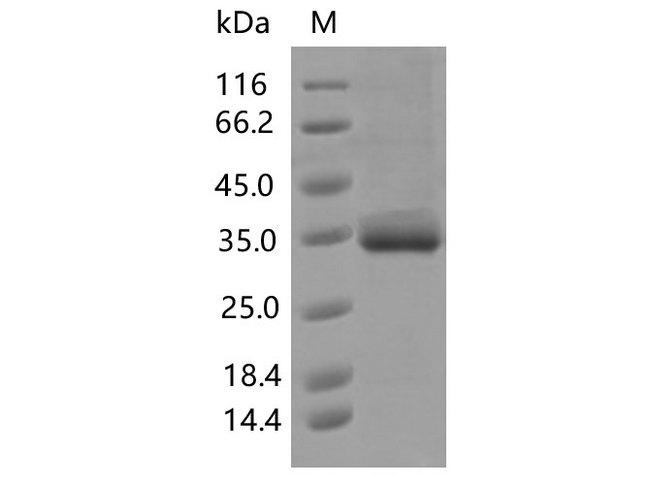 SARS-CoV-2 Spike Glycoprotein Protein - Recombinant SARS-CoV-2 Spike RBD(V483I)(His Tag)