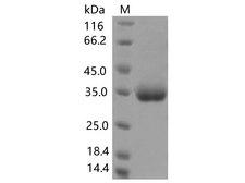 SARS-CoV-2 Spike Glycoprotein Protein - Recombinant SARS-CoV-2 Spike RBD(K378R)(His Tag)