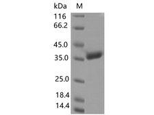 SARS-CoV-2 Spike Glycoprotein Protein - Recombinant SARS-CoV-2 Spike RBD(A344S)(His Tag)