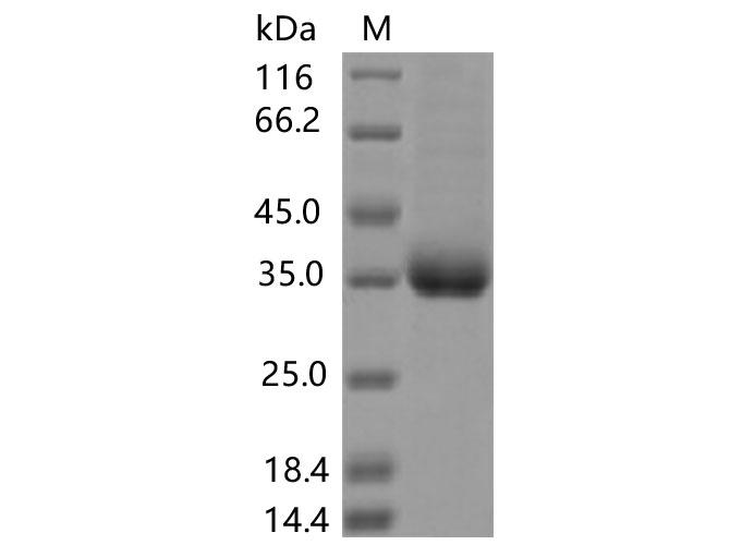 SARS-CoV-2 Spike Glycoprotein Protein - Recombinant SARS-CoV-2 Spike RBD(A520V)(His Tag)