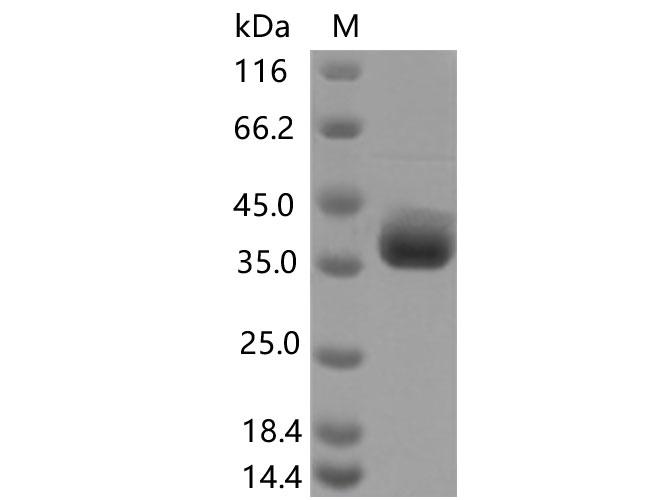 SARS-CoV-2 Spike Glycoprotein Protein - Recombinant SARS-CoV-2 Spike RBD(F490S)(His Tag)