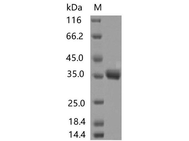 SARS-CoV-2 Spike Glycoprotein Protein - Recombinant SARS-CoV-2 Spike RBD(K378N)(His Tag)