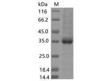 SARS-CoV-2 Spike Glycoprotein Protein - Recombinant SARS-CoV-2 Spike RBD(N370S)(His Tag)