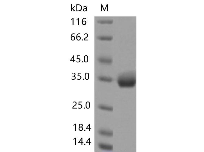 SARS-CoV-2 Spike Glycoprotein Protein - Recombinant SARS-CoV-2 Spike RBD(S477N)(His Tag)