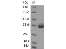 SARS-CoV-2 Spike Glycoprotein Protein - Recombinant SARS-CoV-2 Spike RBD(S477N)(His Tag)