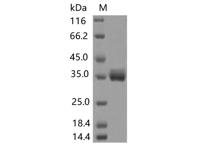 SARS-CoV-2 Spike Glycoprotein Protein - Recombinant SARS-CoV-2 Spike RBD(T385A)(His Tag)