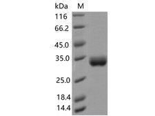 SARS-CoV-2 Spike Glycoprotein Protein - Recombinant SARS-CoV-2 Spike RBD(A475V)(His Tag)