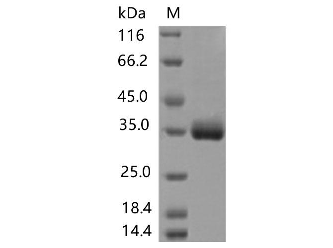 SARS-CoV-2 Spike Glycoprotein Protein - Recombinant SARS-CoV-2 Spike RBD(T393P)(His Tag)