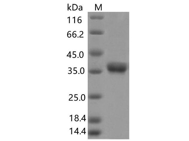 SARS-CoV-2 Spike Glycoprotein Protein - Recombinant SARS-CoV-2 Spike RBD(V395I)(His Tag)