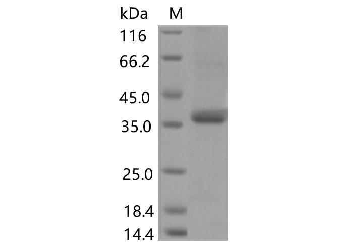 SARS-CoV-2 Spike Glycoprotein Protein - Recombinant SARS-CoV-2 Spike RBD(G482S)(His Tag)