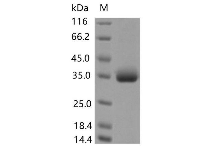 SARS-CoV-2 Spike Glycoprotein Protein - Recombinant SARS-CoV-2 Spike RBD(P479S)(His Tag)