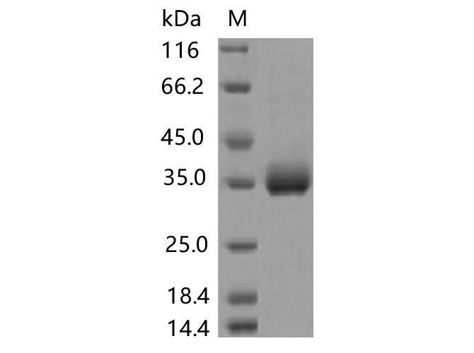 SARS-CoV-2 Spike Glycoprotein Protein - Recombinant SARS-CoV-2 Spike RBD(P337S)(His Tag)