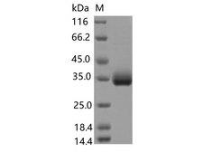 SARS-CoV-2 Spike Glycoprotein Protein - Recombinant SARS-CoV-2 Spike RBD(E471Q)(His Tag)