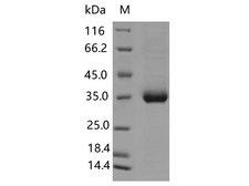 SARS-CoV-2 Spike Glycoprotein Protein - Recombinant SARS-CoV-2 Spike RBD(L455F)(His Tag)