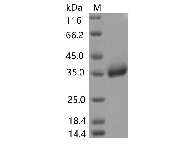 SARS-CoV-2 Spike Glycoprotein Protein - Recombinant SARS-CoV-2 Spike RBD(P521R)(His Tag)
