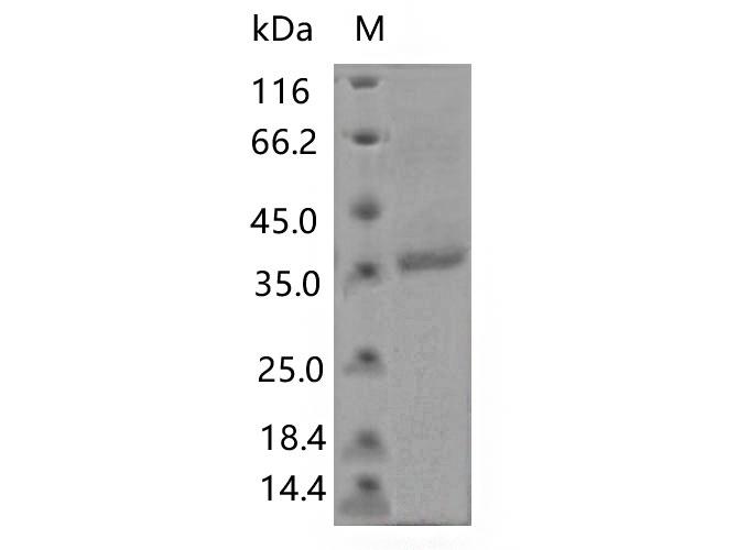SARS-CoV-2 Spike Glycoprotein Protein - Recombinant SARS-CoV-2 Spike RBD(K458Q)(His Tag)