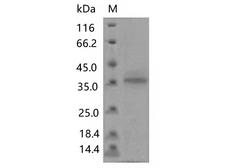 SARS-CoV-2 Spike Glycoprotein Protein - Recombinant SARS-CoV-2 Spike RBD(F456L)(His Tag)