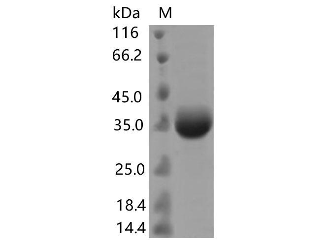 SARS-CoV-2 Spike Glycoprotein Protein - Recombinant SARS-CoV-2 Spike RBD(G446S)(His Tag)