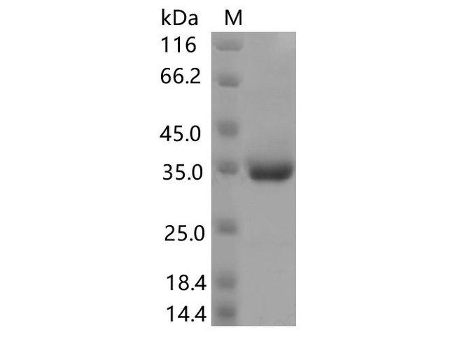 SARS-CoV-2 Spike Glycoprotein Protein - Recombinant SARS-CoV-2 Spike RBD(P499R)(His Tag)