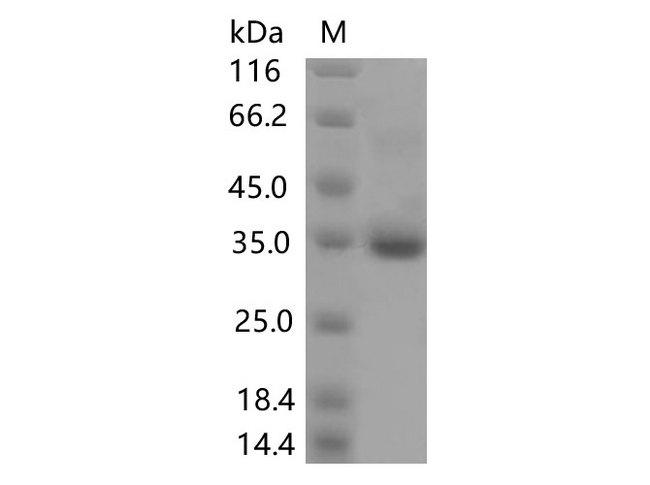 SARS-CoV-2 Spike Glycoprotein Protein - Recombinant SARS-CoV-2 Spike RBD(V445F)(His Tag)