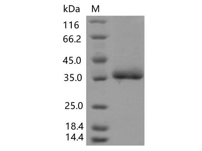 SARS-CoV-2 Spike Glycoprotein Protein - Recombinant SARS-CoV-2 Spike RBD(F490L)(His Tag)