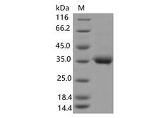 SARS-CoV-2 Spike Glycoprotein Protein - Recombinant SARS-CoV-2 Spike RBD(E484Q)(His Tag)