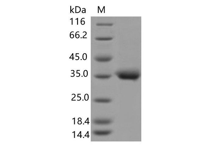 SARS-CoV-2 Spike Glycoprotein Protein - Recombinant SARS-CoV-2 Spike RBD(E484Q)(His Tag)