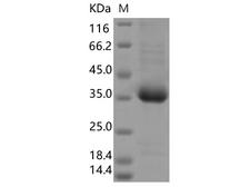 SARS-CoV-2 Spike Glycoprotein Protein - Recombinant SARS-CoV-2 Spike RBD(V503F)(His Tag)