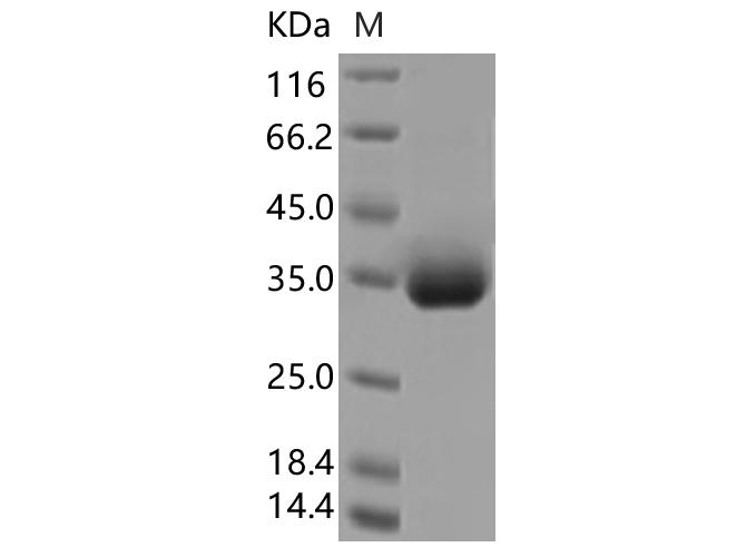 SARS-CoV-2 Spike Glycoprotein Protein - Recombinant SARS-CoV-2 Spike RBD(A522V)(His Tag)