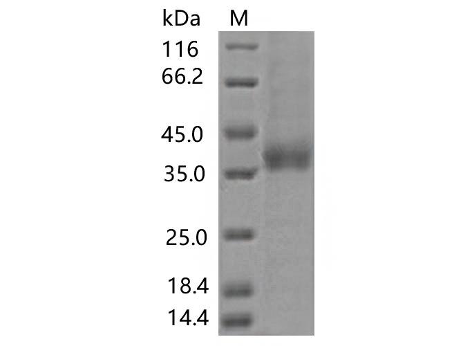 SARS-CoV-2 Spike Glycoprotein Protein - Recombinant SARS-CoV-2 Spike RBD(A372T)(His Tag)