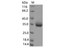 SARS-CoV-2 Spike Glycoprotein Protein - Recombinant SARS-CoV-2 Spike RBD(S359N)(His Tag)