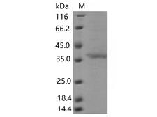 SARS-CoV-2 Spike Glycoprotein Protein - Recombinant SARS-CoV-2 Spike RBD(G446V)(His Tag)