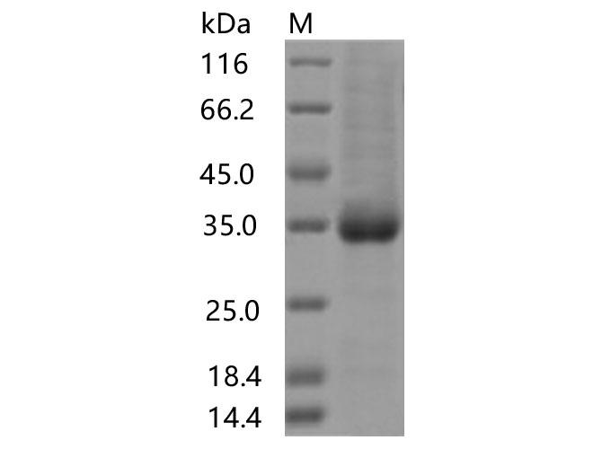 SARS-CoV-2 Spike Glycoprotein Protein - Recombinant SARS-CoV-2 Spike RBD(S477I)(His Tag)