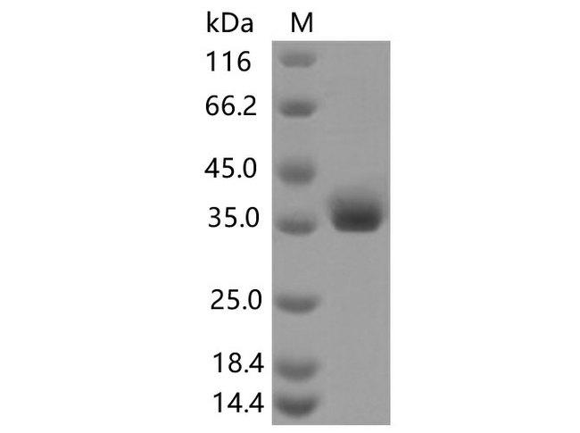 SARS-CoV-2 Spike Glycoprotein Protein - Recombinant SARS-CoV-2 Spike RBD(K444R)(His Tag)
