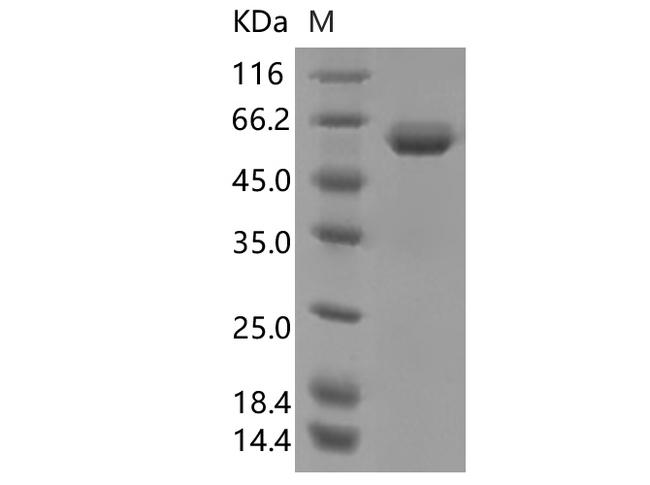 SARS-CoV-2 Spike Glycoprotein Protein - Recombinant SARS-CoV-2 Spike RBD (N501Y)(Fc Tag)