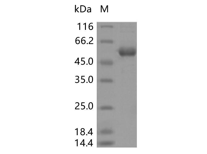 SARS-CoV-2 Spike Glycoprotein Protein - Recombinant SARS-CoV-2 Spike RBD (E484K)(rFc Tag)