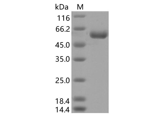 SARS-CoV-2 Spike Glycoprotein Protein - Recombinant SARS-CoV-2 Spike RBD (K417N)(rFc Tag)