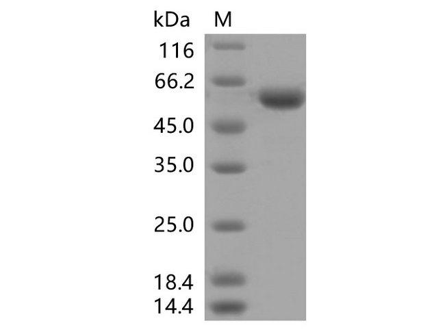 SARS-CoV-2 Spike Glycoprotein Protein - Recombinant SARS-CoV-2 Spike RBD (K417T, E484K, N501Y)(rFc Tag)
