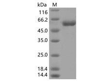 SARS-CoV-2 Spike Glycoprotein Protein - Recombinant SARS-CoV-2 Spike RBD (K417T)(rFc Tag)