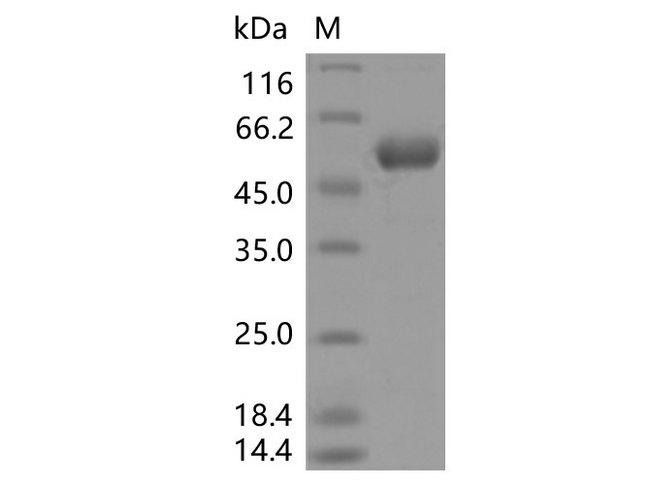 SARS-CoV-2 Spike Glycoprotein Protein - Recombinant SARS-CoV-2 Spike RBD (Y453F)(rFc Tag)
