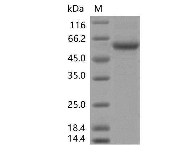 SARS-CoV-2 Spike Glycoprotein Protein - Recombinant SARS-CoV-2 Spike RBD (K417N, E484K, N501Y)(rFc Tag)