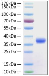 SARS-CoV-2 Spike Glycoprotein Protein - Recombinant 2019-nCoV Spike RBD Protein was determined by SDS-PAGE with Coomassie Blue, showing a band at 36 kDa.
