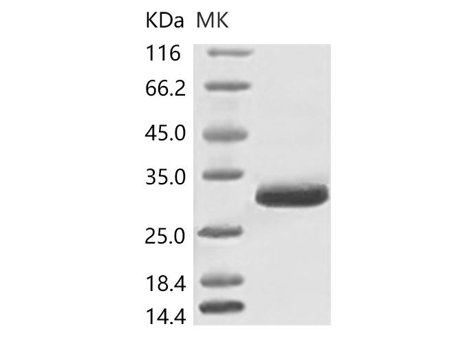 SARS-CoV-2 Spike Glycoprotein Protein