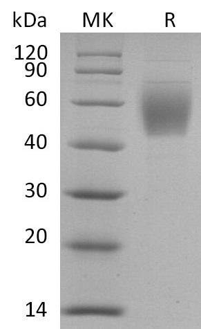 SARS-CoV-2 Spike Glycoprotein Protein