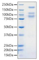 SARS-CoV-2 Spike Glycoprotein Protein - Recombinant 2019-nCoV S1+S2 ECD (S-ECD) Protein was determined by SDS-PAGE with Coomassie Blue, showing bands around 80, 110, 180 kDa.