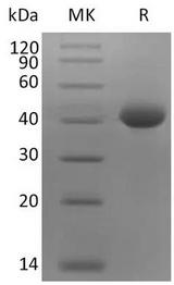 SARS-CoV-2 Spike Glycoprotein Protein