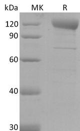 SARS-CoV-2 Spike Glycoprotein Protein